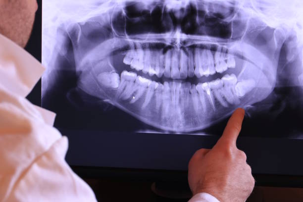 Best Urgent Tooth Repair  in Lone Grove, OK