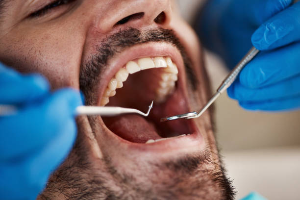 Best Urgent Tooth Repair  in Lone Grove, OK