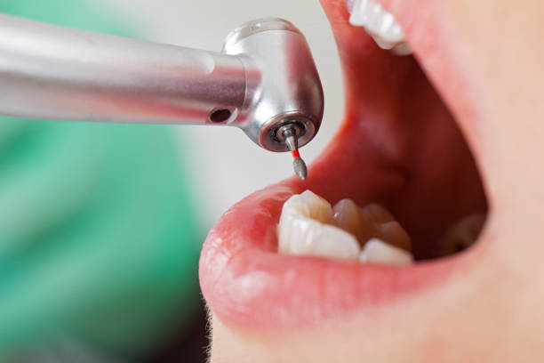 Best Broken Tooth Emergency  in Lone Grove, OK